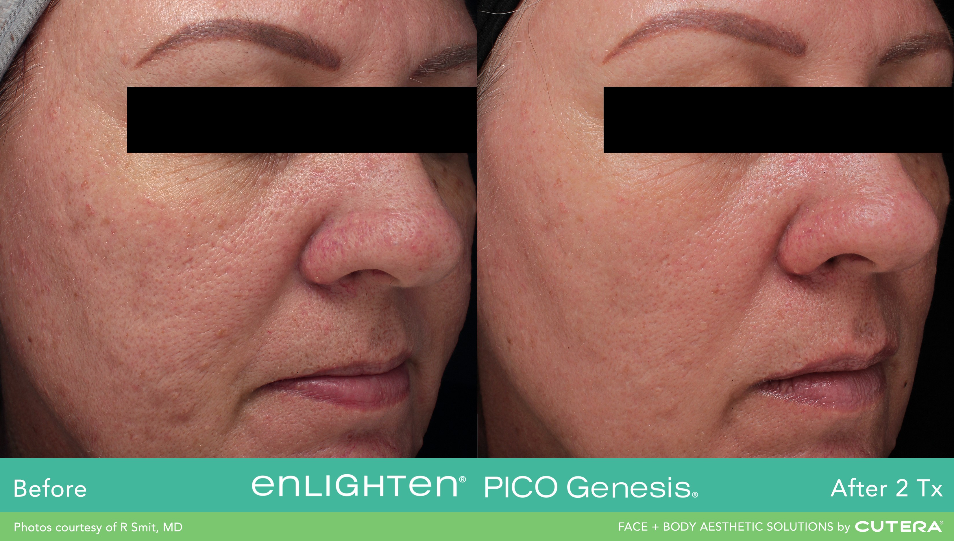 enlighten Pico Genesis Dr Smit BA